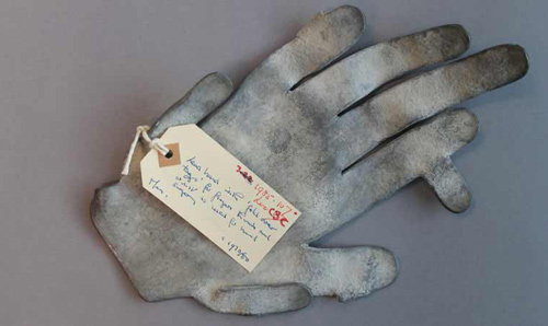 Lead hand used in hand surgery